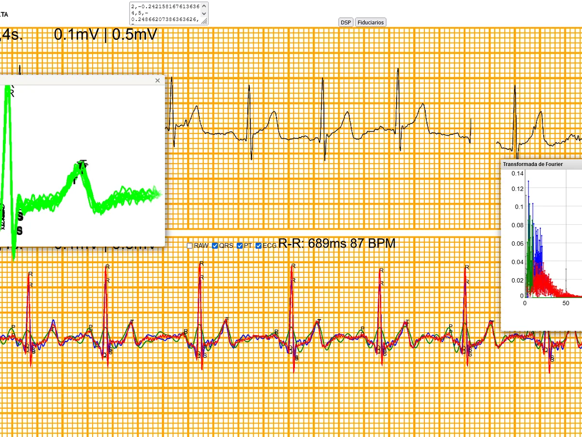 Panel del ECG con la señal, el complejo QRS ampliado y el espectro de la FFT